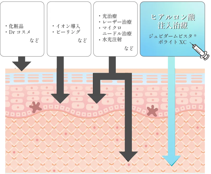 ターゲット・アプローチ層