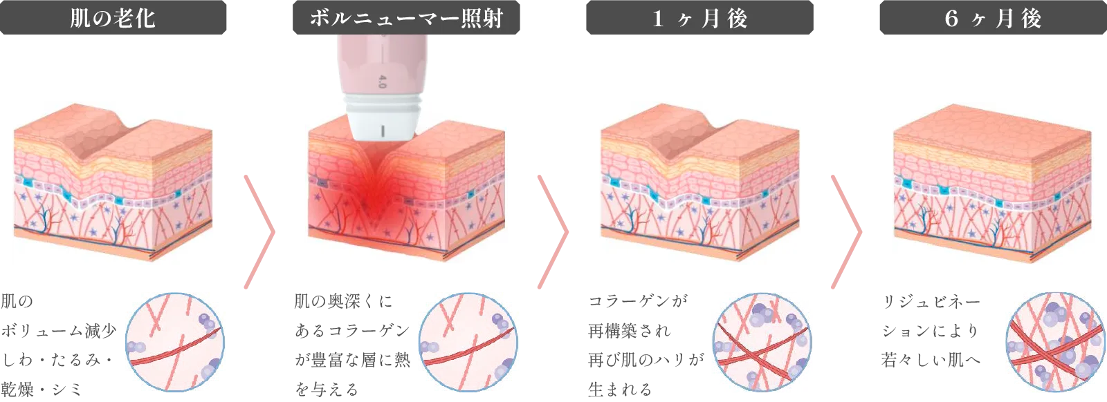 メカニズム説明